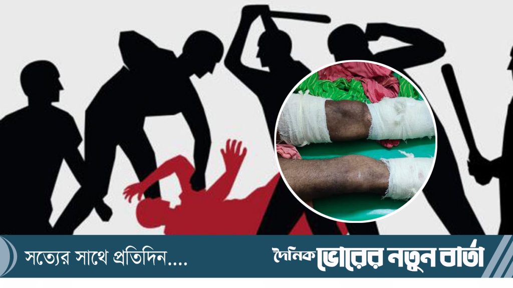তিতাসে পূর্ব শত্রুতার জের ধরে প্রতিপক্ষের ওপর হামলা: আহত ২