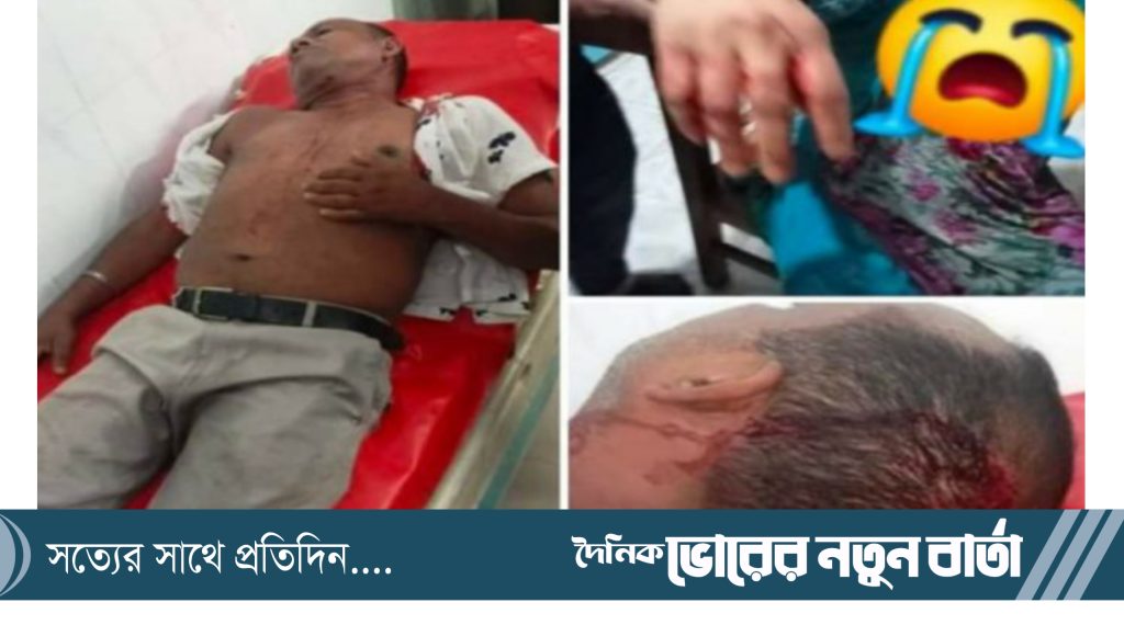 আহারে সাংবাদিক! আহারে সাংবাদিকতা!