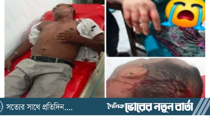 আহারে সাংবাদিক! আহারে সাংবাদিকতা!