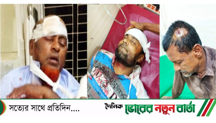 তিতাসে মসজিদ- মাদ্রাসার সভাপতির পদকে কেন্দ্র করে চারজনকে কুপিয়ে জখম 
