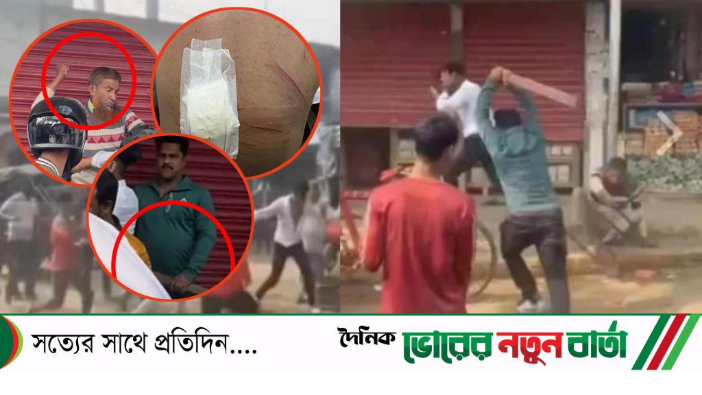 দাউদকান্দিতে শিক্ষার্থীদের উপর হামলায় ৪ জন আহত-মহাসড়ক অবরোধ